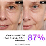 سرم رتینول اینکی لیست - تصویر 3