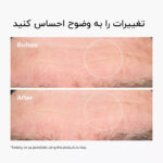 سرم آبرسان هیالورونیک اسید حاوی سراماید اوردینری - تصویر 2