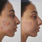 سرم رتینول سوپر سولوشن 1% اینکی لیست - تصویر 3