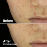 سرم درمان جوش AHA 2 BHA 2 کوزارکس - تصویر 3