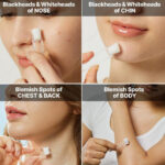 سرم درمان جوش AHA 2 BHA 2 کوزارکس - تصویر 4