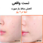 سرم هایپر نیاسینامید ایزنتری - تصویر 2