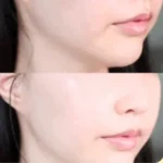 آمپول روشن کننده سی نیاسین ایزنتری - تصویر 3