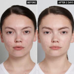 تونر PHA اینکی لیست - تصویر 2