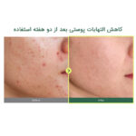 تونر تسکین دهنده آنوا مدل Hearthleaf 77% - تصویر 3