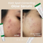 سرم ضد لک اکسیس وای - تصویر 2