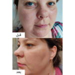 ست روشن کننده برنج بیوتی آف جوسان - تصویر 3