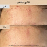 ماسک درخشان کننده برنج و عسل بیوتی آف جوسان - تصویر 2