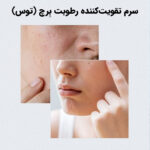 سرم آبرسان توس ۷۰٪ آنوا