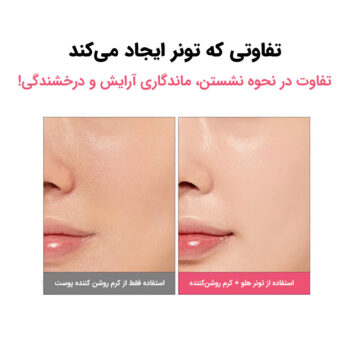 تونر اسنس هلو ۷۷٪ نیاسین آنوا