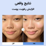 سرم آبرسان هیالورونیک اسید کوزارکس - تصویر 2