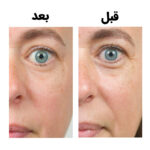  مرطوب کننده بایواکتیو سرامید اینکی لیست