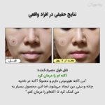 اسنس آبرسان حلزون و پپتاید جومیسو