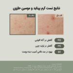 کرم آبرسان موسین حلزون و پپتاید جومیسو