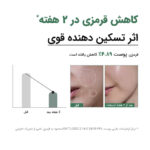 Anua-Heartleaf-80%-Moisture-Soothing-Ampoule-سرم تسکین دهنده پوست آنوا
