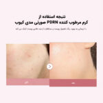 Medicube-PDRN-Pink-Hyaluronic-Moisturizing-Cream- کرم مرطوب کننده PDRN هیدرولیز شده صورتی مدی کیوب