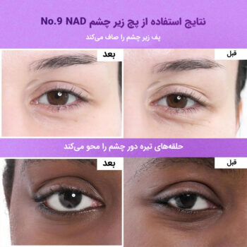 Numbuzin-No.9-NAD-Collagen-Under-Eye-Patches-پچ زیر چشم نامبوزین ۹ NAD